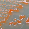 Red-orange colored Deinococcus colonies on nutrient agar.