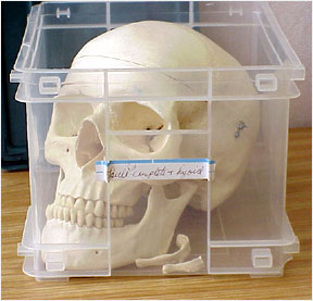 Photo of plastic human skull