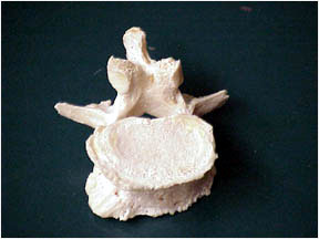Photo of Human vertebra