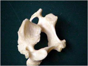 Photo of human vertebra