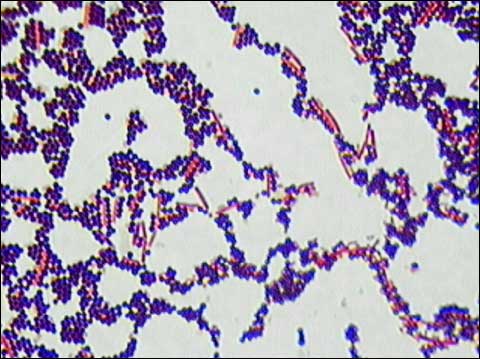 staphylococcus aureus gram stain. Gram stain