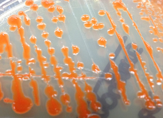 Orange-colored bacteria colonies on nutrient agar.